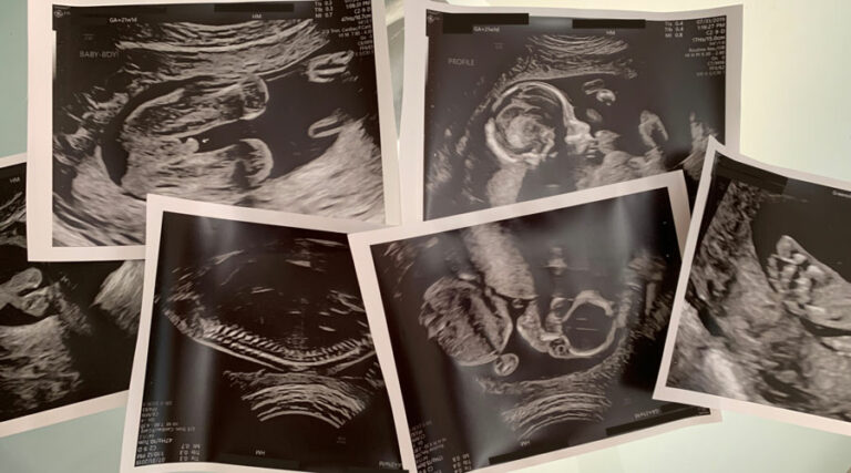 week 21 sebastian featured image