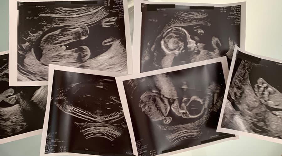 week 21 sebastian featured image